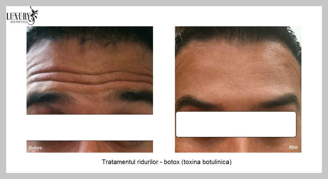 cea mai bună cremă hidratantă anti-îmbătrânire pentru recenzii feței crema de ochi antirid loreal